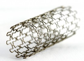 Stent for cardiac intervention 